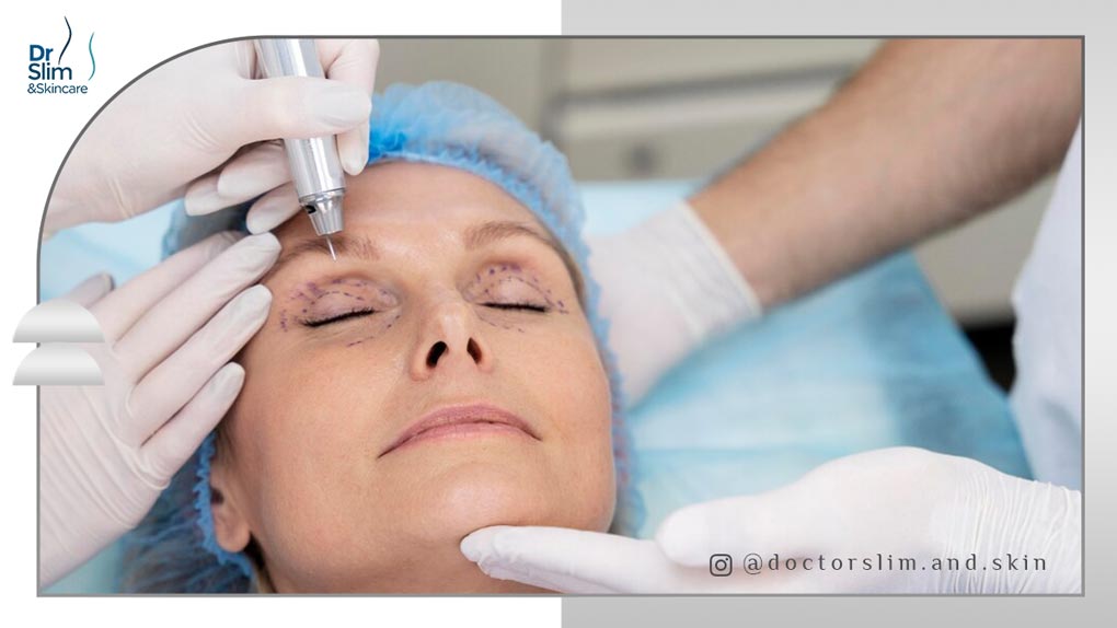 جوانسازی دور چشم با لیزر