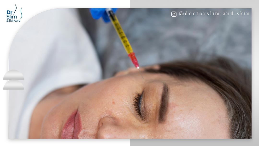 رفع تیرگی زیر چشم با مزوتراپی