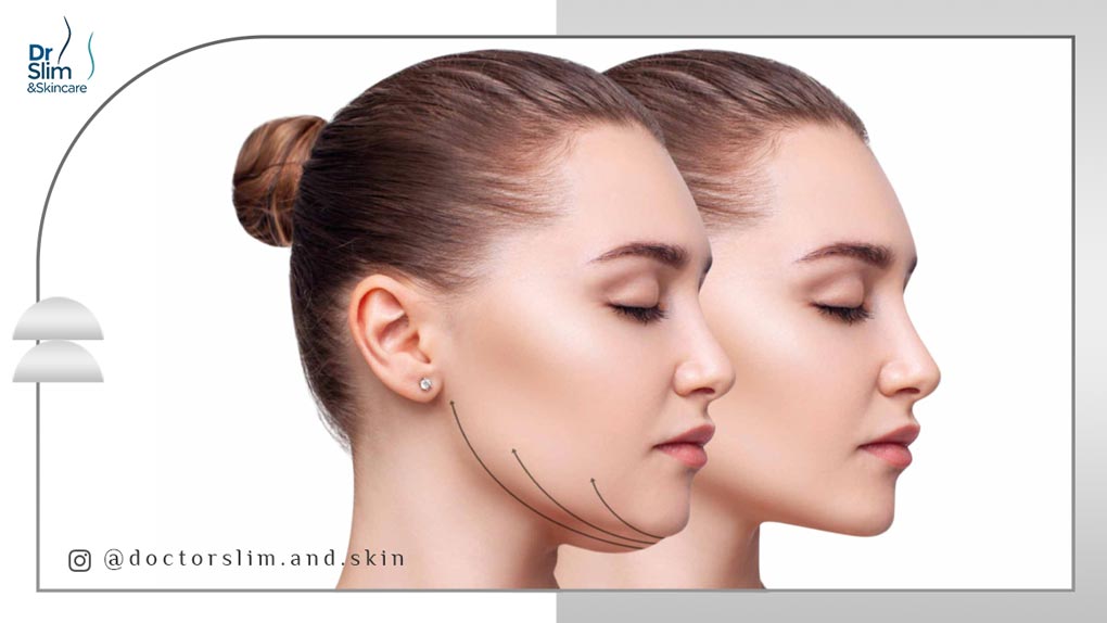 راه ‌های لاغری صورت