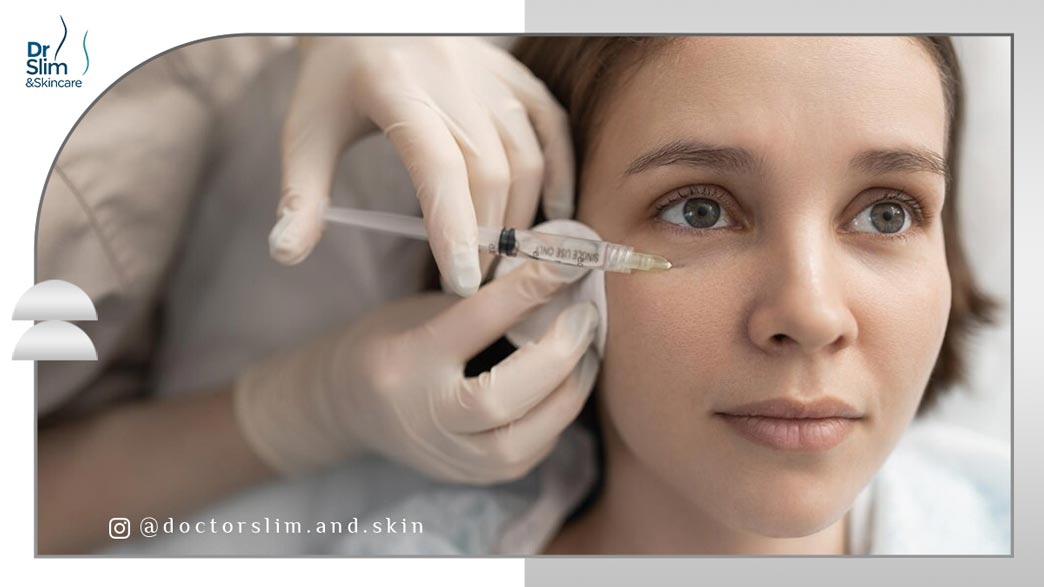 بوتاکس برای گودی زیر چشم