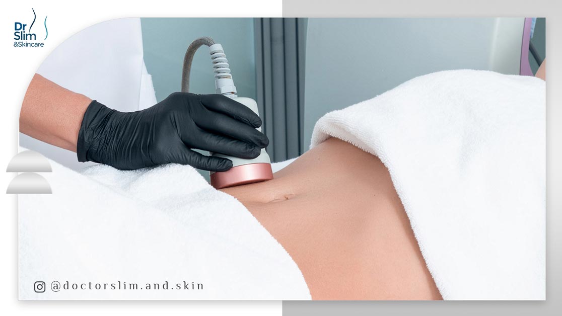 کویتیشن بهتر است یا آر اف