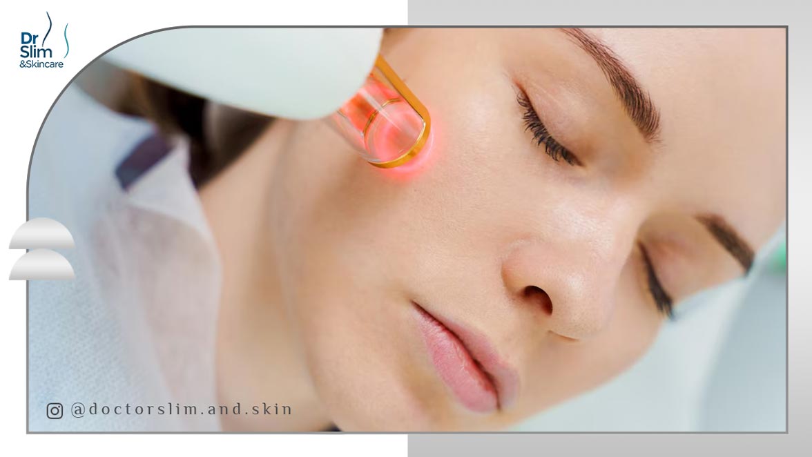 بهترین لیزر برای هایپرپیگمنتیشن صورت
