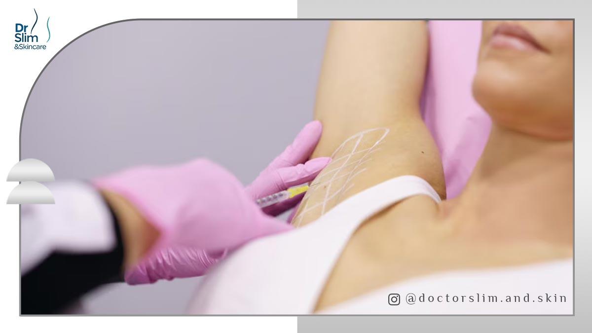 رفع بوی بد زیر بغل با بوتاکس