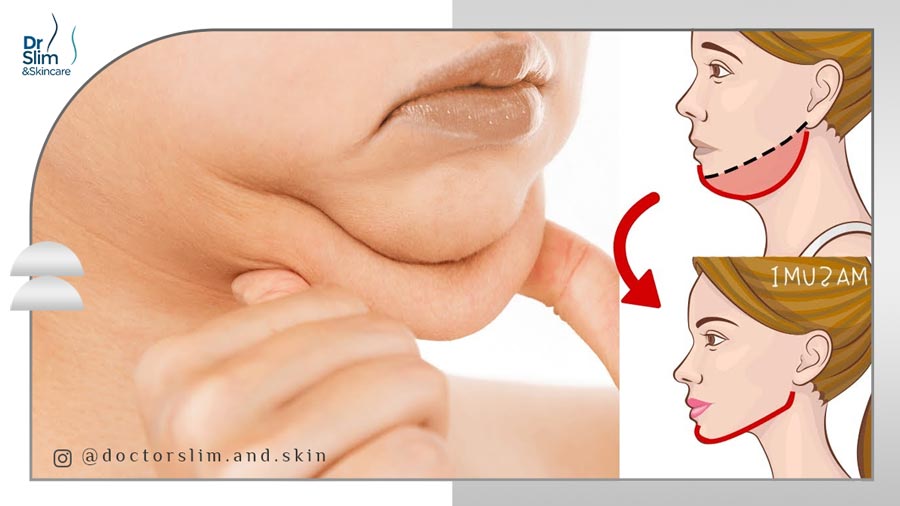 ورزش برای لاغری صورت و غبغب