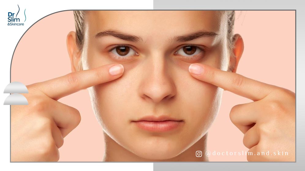 دلایل سیاهی زیر چشم