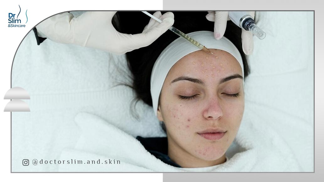 درمان لک صورت با مزوتراپی