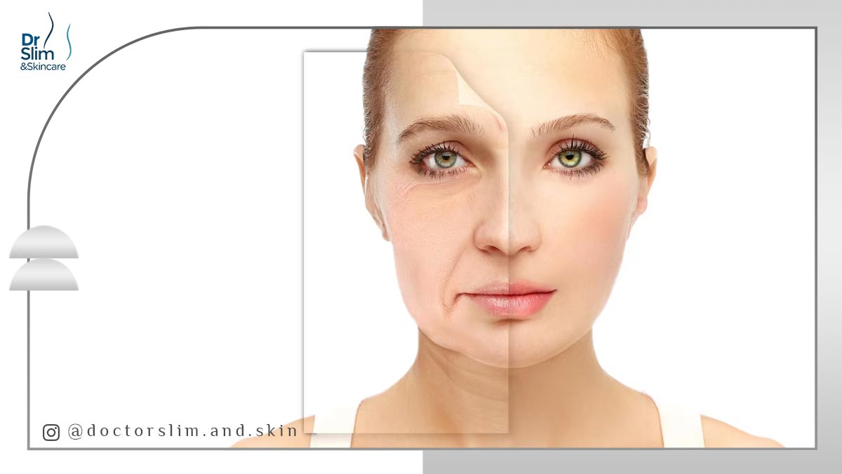 لیفت و جوانسازی زیر چشم