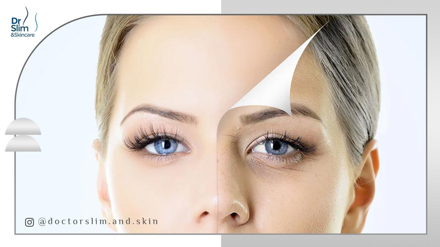 جوانسازی دور چشم با لیزر