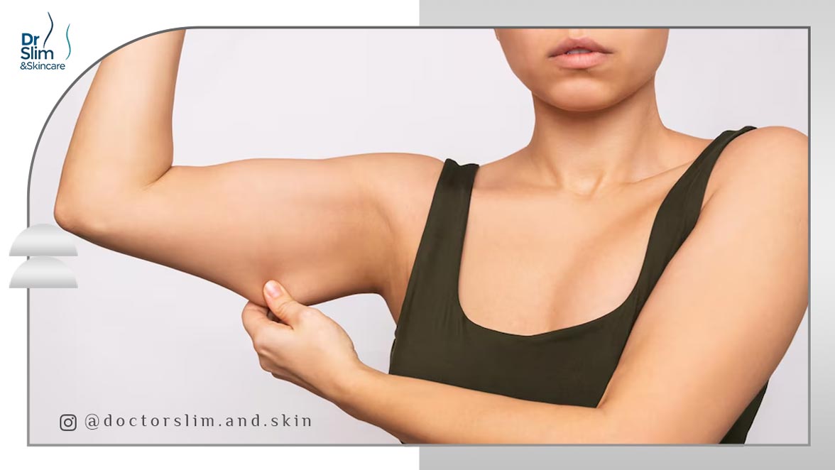 کویتیشن برای لاغری بازو