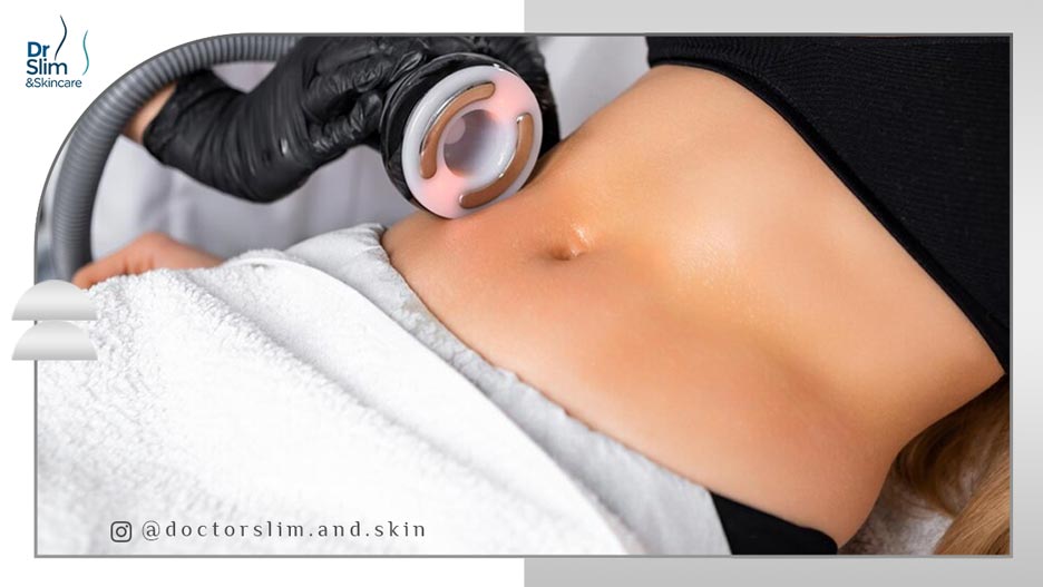 لاغری شکم با کویتیشن