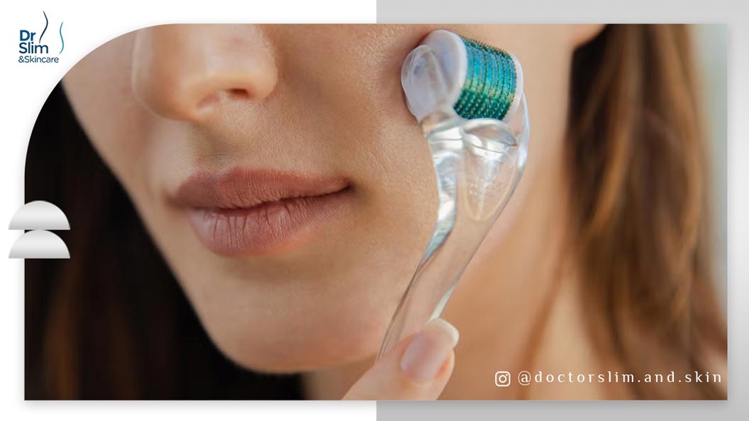 درمارولر از بین برنده لک و جای زخم و جوش صورت