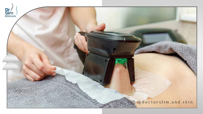 مزایای لاغری موضعی با کرایولیپولیز