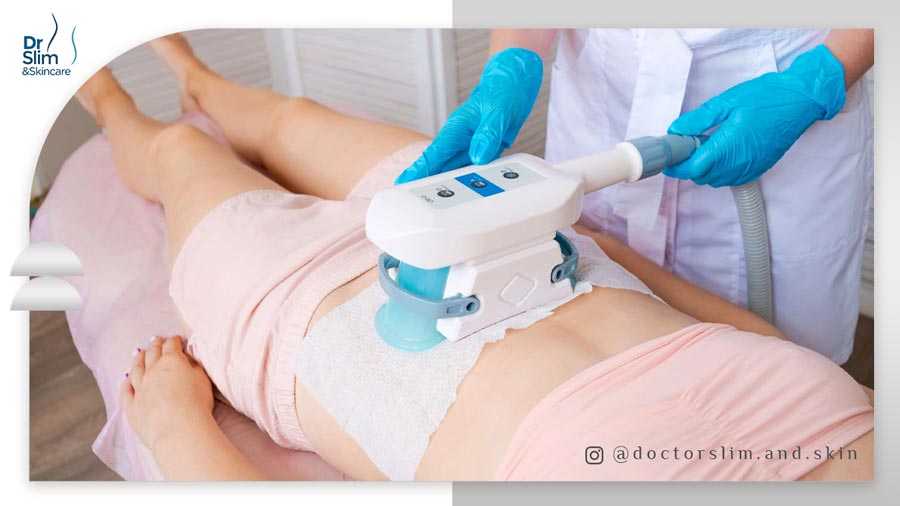 کاهش وزن بی برو برگرد با دستگاه کول اسکالپتینگ 2025