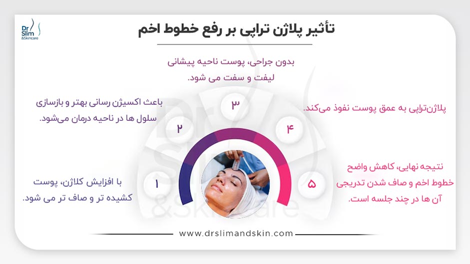 رفع خطوط اخم با پلاژن‌ تراپی