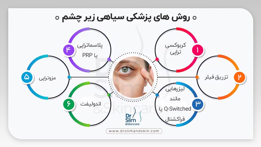 رفع سیاهی زیر چشم