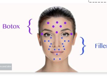 بوتاکس یا فیلر تفاوت ‌ها و کاربرد ها
