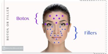 بوتاکس یا فیلر تفاوت ‌ها و کاربرد ها