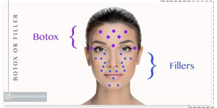 بوتاکس یا فیلر تفاوت ها و کاربرد ها