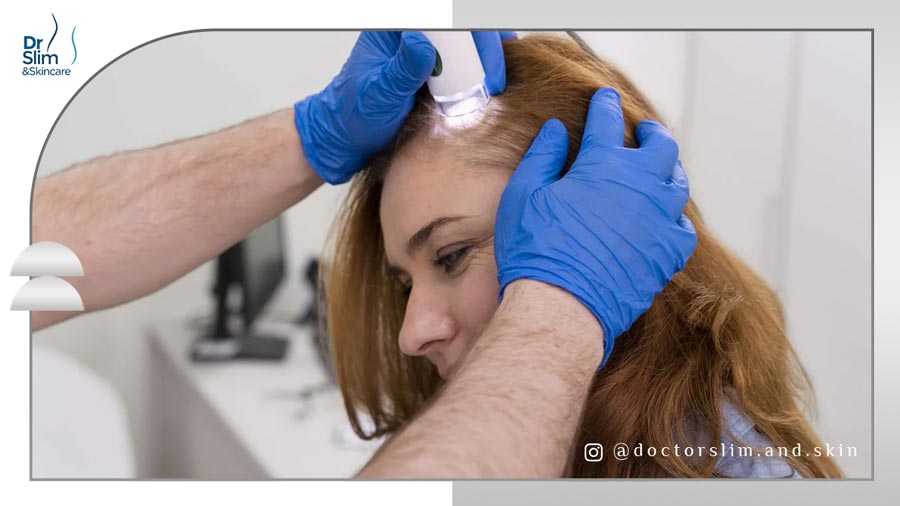 درمان ریزش مو