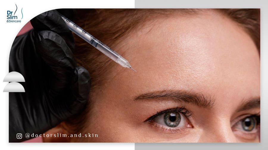 بوتاکس پیشانی