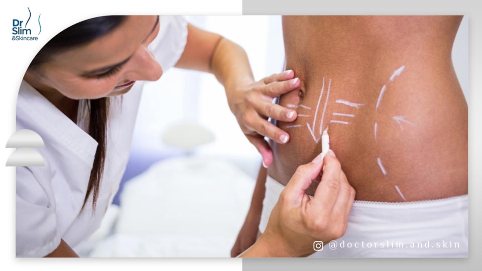 روش لاغری موضعی