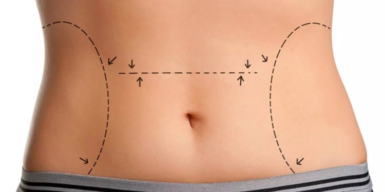 چگونه بدون جراحی لاغر شویم