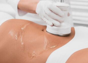 کاربرد لیپوسونیکس برای بازو، ران، پهلو و غبغب