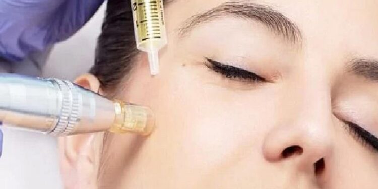 مزونیدلینگ صورت