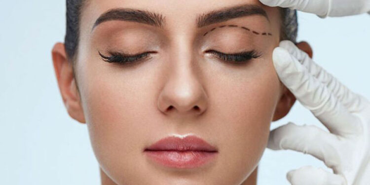 کشیدن پلک بدون جراحی