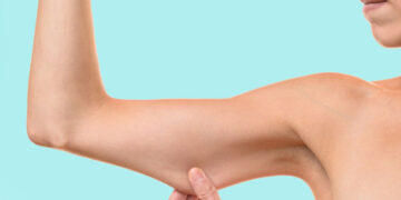 لاغری موضعی بازو با دستگاه