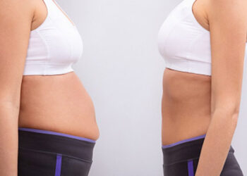 لاغری شکم با دستگاه هایفو