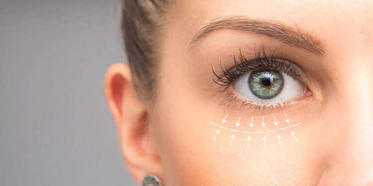 کشیدن پلک و ابرو