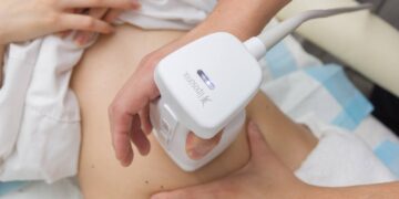 از بین بردن چربی ها با لیپوسونیکس در دو جلسه