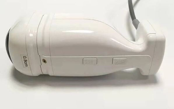 لاغری شکم و پهلو با دستگاه هایفوی آمریکایی لیپوسونیکس