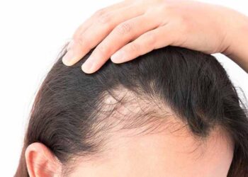 رشد مجدد مو