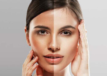 سفید شدن پوست