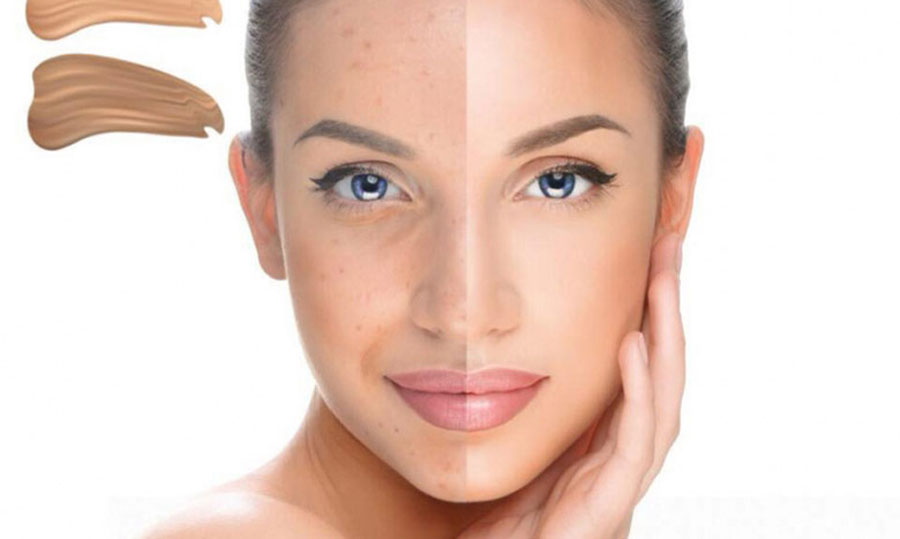 مزووایت چیست