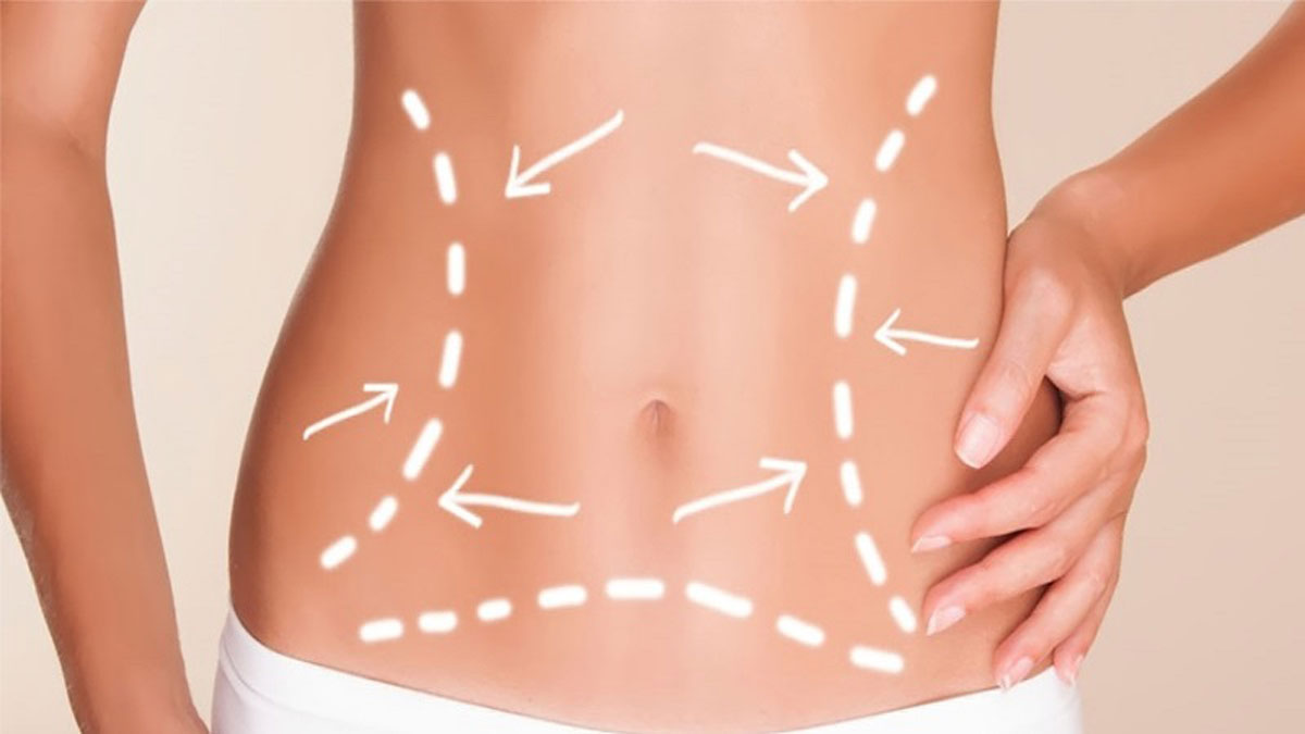 لیزر لاغری چیست