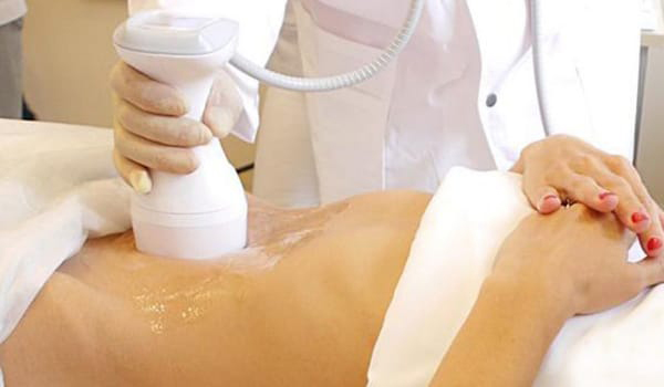 از بین بردن چربی ها با لیپوسونیکس در دو جلسه