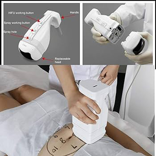 لاغری موضعی با لیپوسونیکس