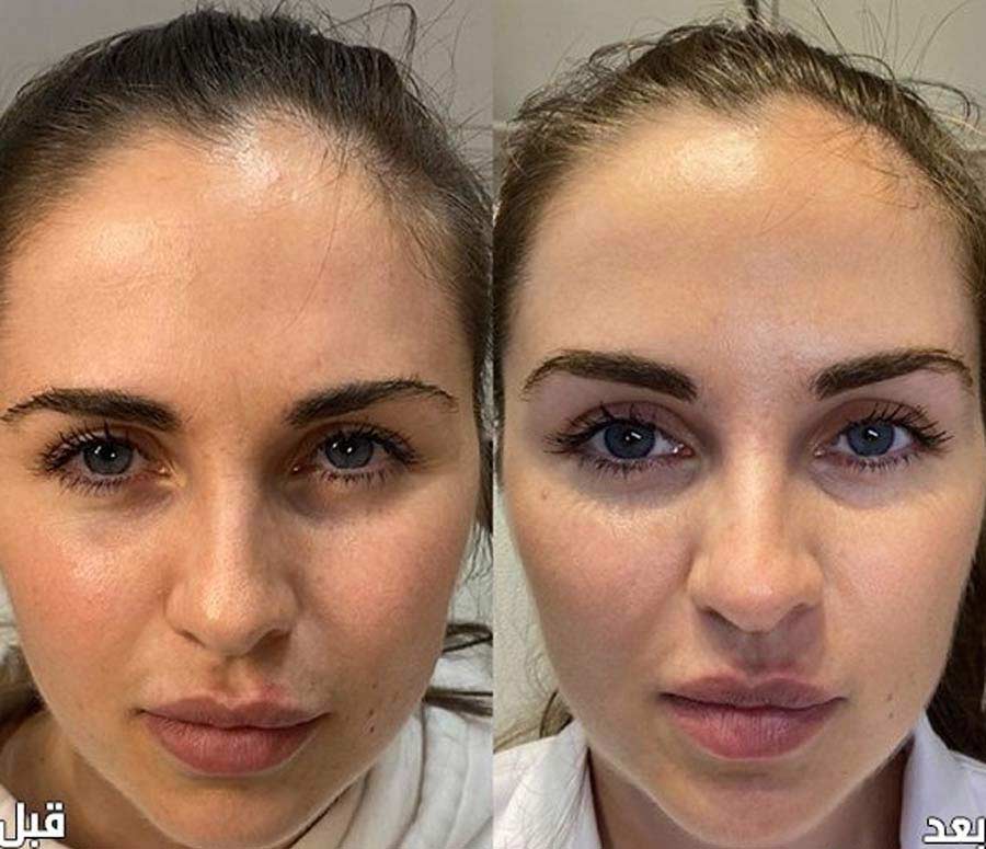 کشیدن پلک و ابرو