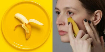 بوتاکس صورت با پوست موز