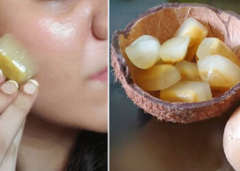 بوتاکس صورت با یخ سیب زمینی