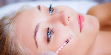 بوتاکس خط اندوه