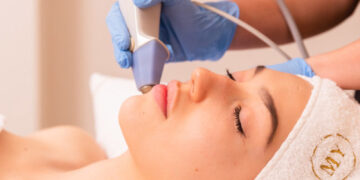 لاغری صورت با اکسیلیس