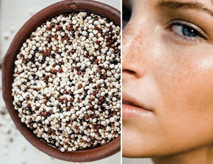 بوتاکس صورت با کینوا