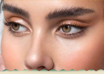 بوتاکس چشم گربه ‌ای