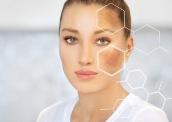 از بین بردن لک صورت فوری