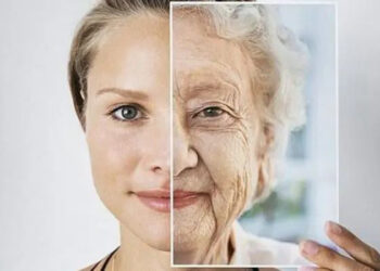 بوتاکس صورت یا روش NAD