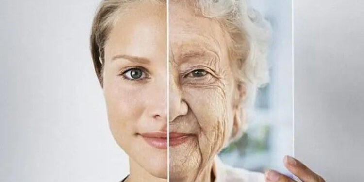 بوتاکس صورت یا روش NAD